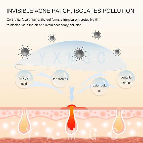 Pimple Patches for Face Hydrocolloid Acne Patches with Tea Tree Oil, Covers Zits, Pimples, and Blemishes on Face and Skin, Multi-Size Zit Patches (240 Patches)