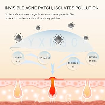 Pimple Patches for Face Hydrocolloid Acne Patches with Tea Tree Oil, Covers Zits, Pimples, and Blemishes on Face and Skin, Multi-Size Zit Patches (240 Patches)