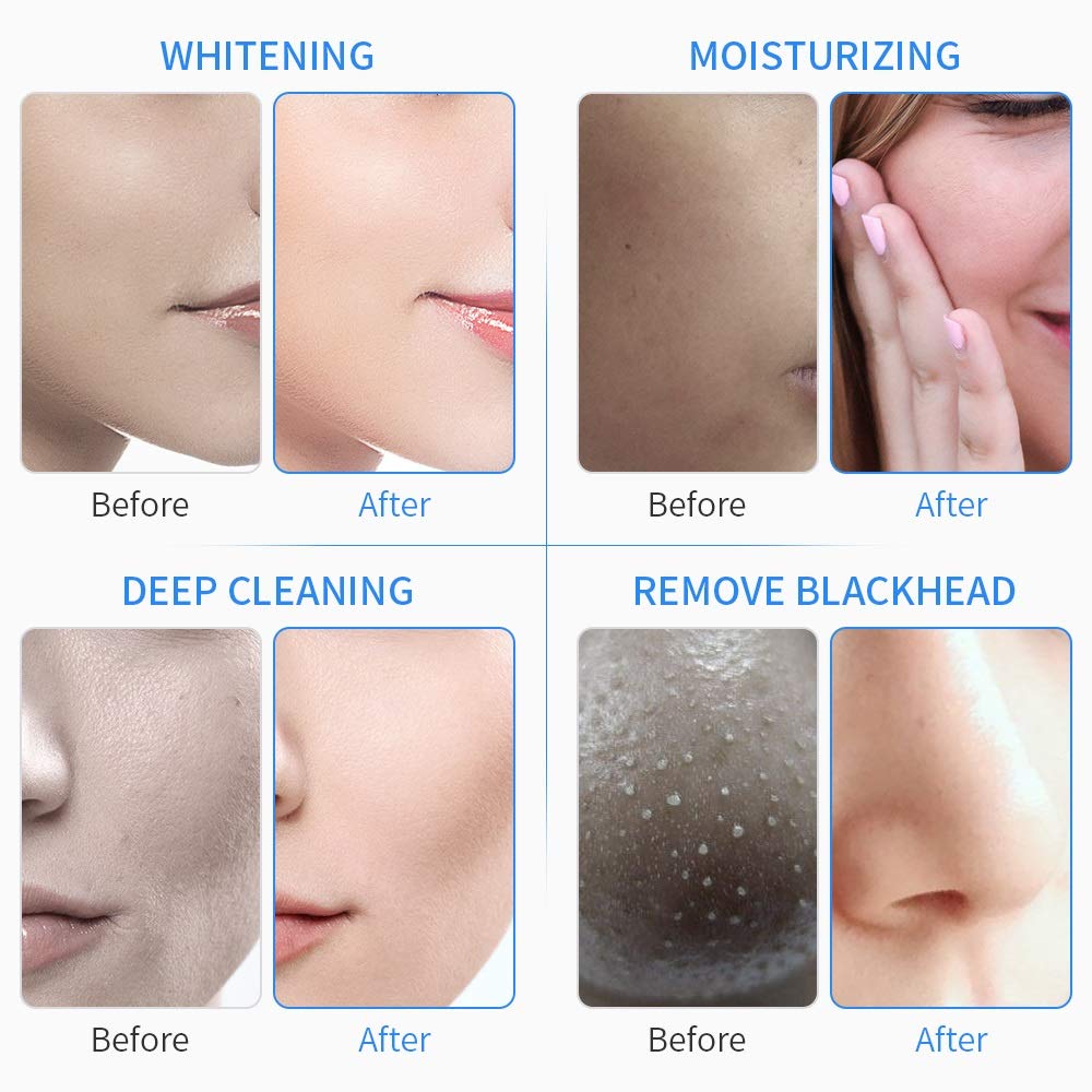 Diamond - Máquina de microdermoabrasión multifunción para limpieza de la piel, hidrodermoabrasión, hidrodermoabrasión, masajeador facial, limpiador de poros, máquina de belleza de burbujas pequeñas