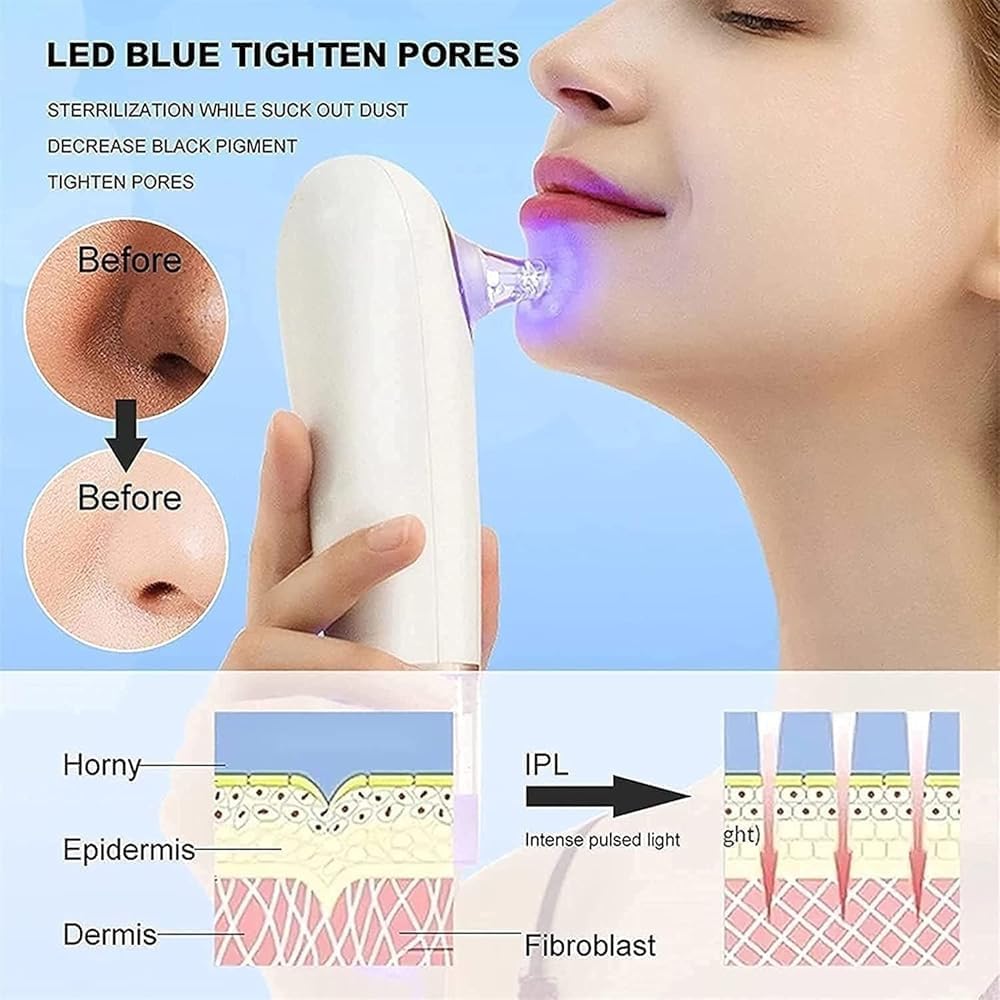 Blackhead Remover Pore Vacuum | Electric Small Bubble Water Cycle Suction Tool | USB Rechargeable Acne Comedo Extractor for Facial Skin Care | Ideal Gift