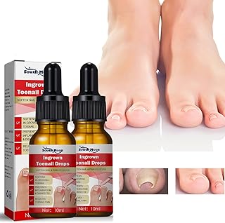 2PCS Ingrown Toenail Treatment,Nail Growth Treatment,Nail Helper Ingrown Toenail Drops,Toenail Correction Treatment Oil,Fungal Nail Treatment,Ingrowing Toenail Treatment,Treatment for Ingrown Toenail