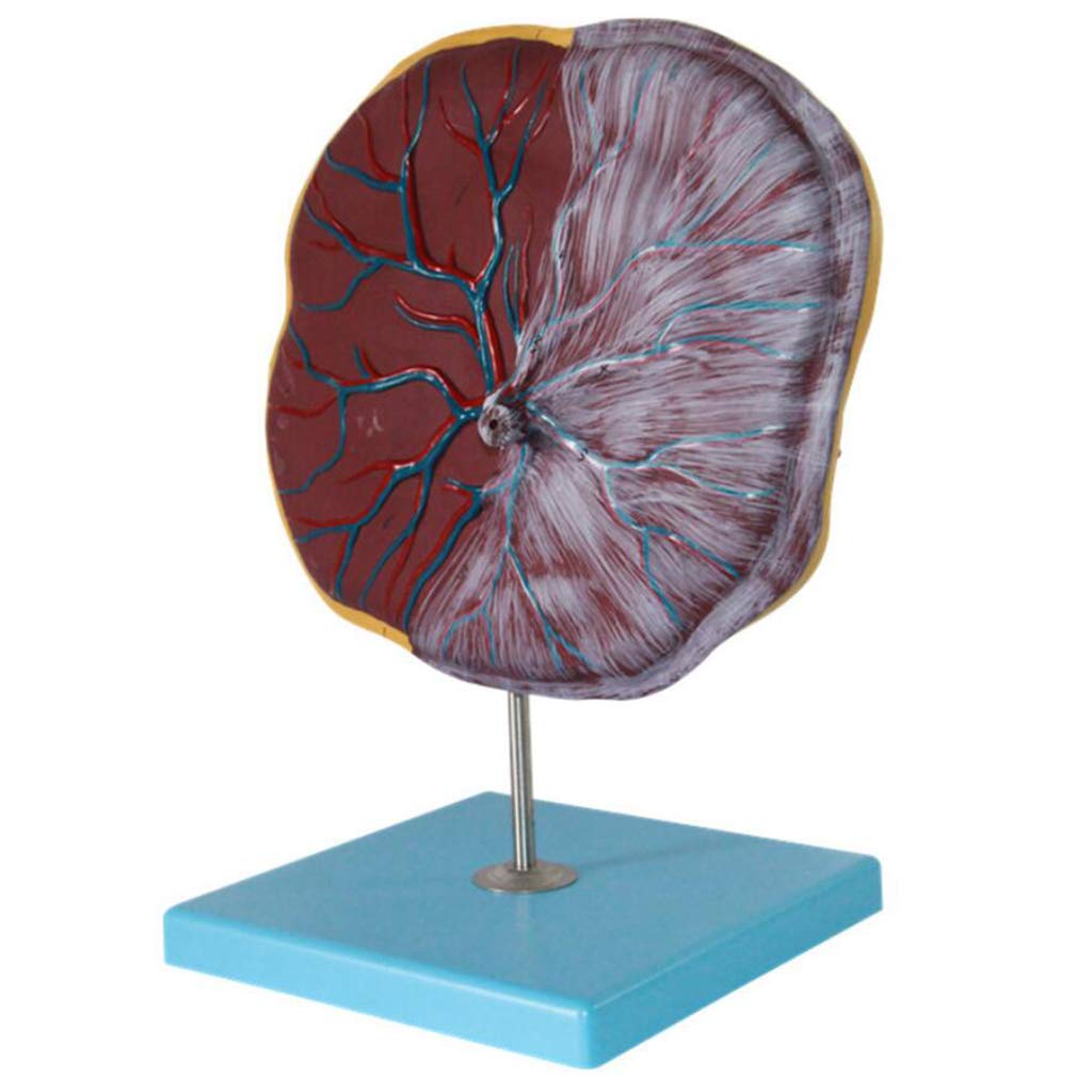 Plazenta- Und Nabelschnurmodell, Medizinische Geräte, Modell Der Menschlichen Anatomie, Medizinisches Lehrmittel, Medizinische Modelle Und Lehrmaterialien