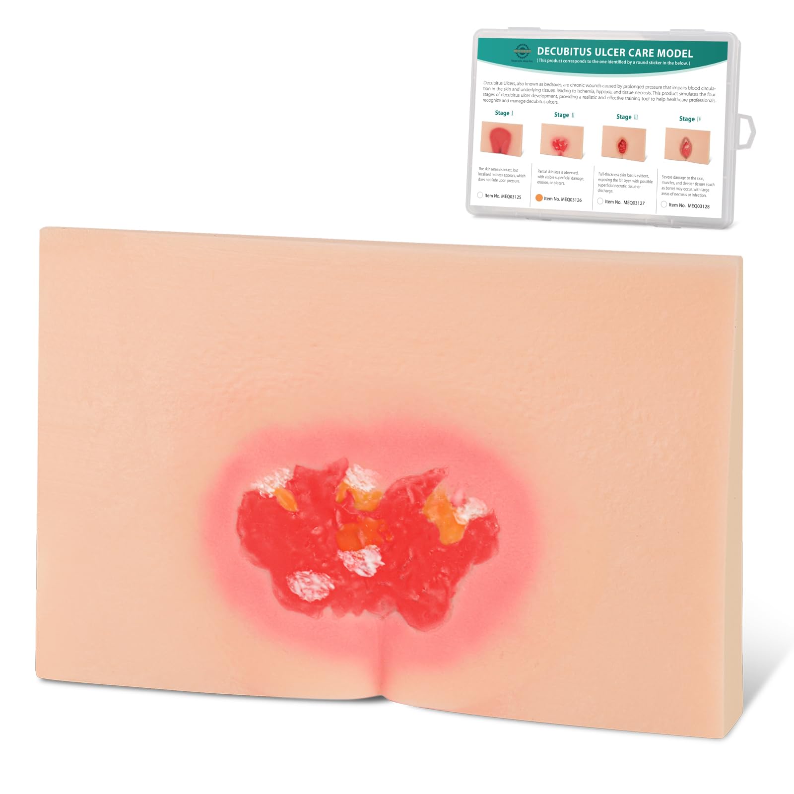Modèle de soins de l'ulcère décubital et modèle d'escarres - 8