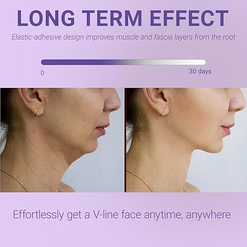 Miniatura 2 de Parches antiarrugas para la frente - Cinta facial - Cinta facial antiarrugas - Cinta antiarrugas - Línea V - Máscara facial antienvejecimiento -