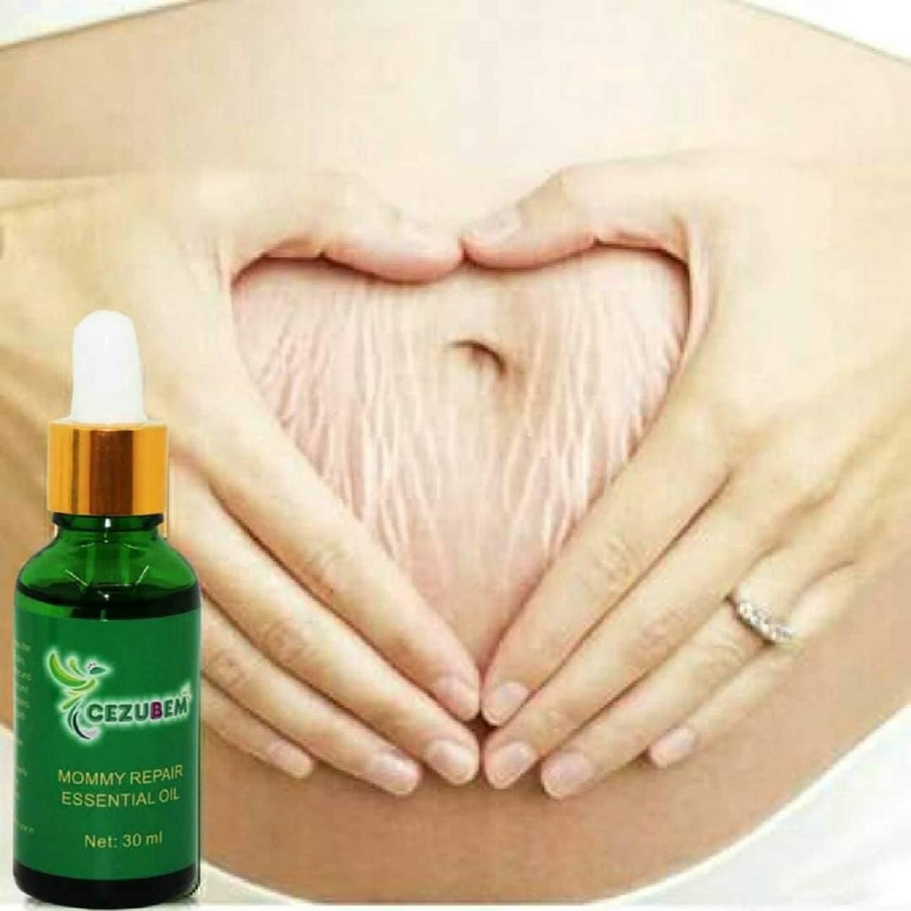 Anti Stretch Marks Massage Oil – Stretch Marks Remover Essential Oil Skin Care Treatment – Penetrates Skin 6X Deeper Than Stretch Mark Cream - Targets Unwanted Fat Tissues & Improves Skin Firmness