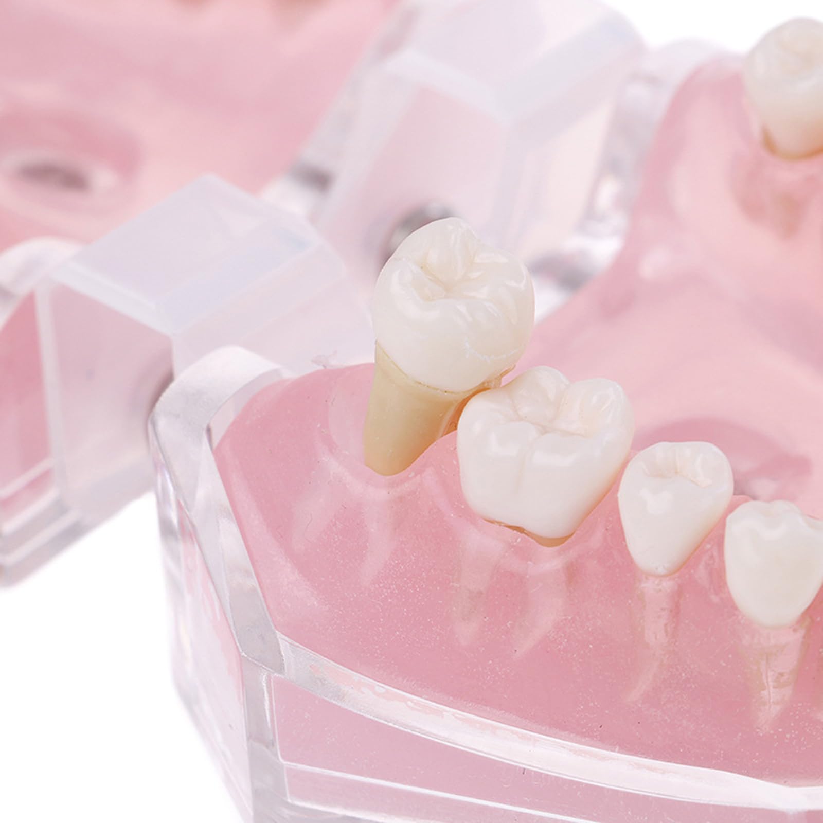 Modelo dental con dientes extraíbles, bandeja suave estándar, modelo dental extraíble, herramienta de enseñanza de materiales de laboratorio dental ideal