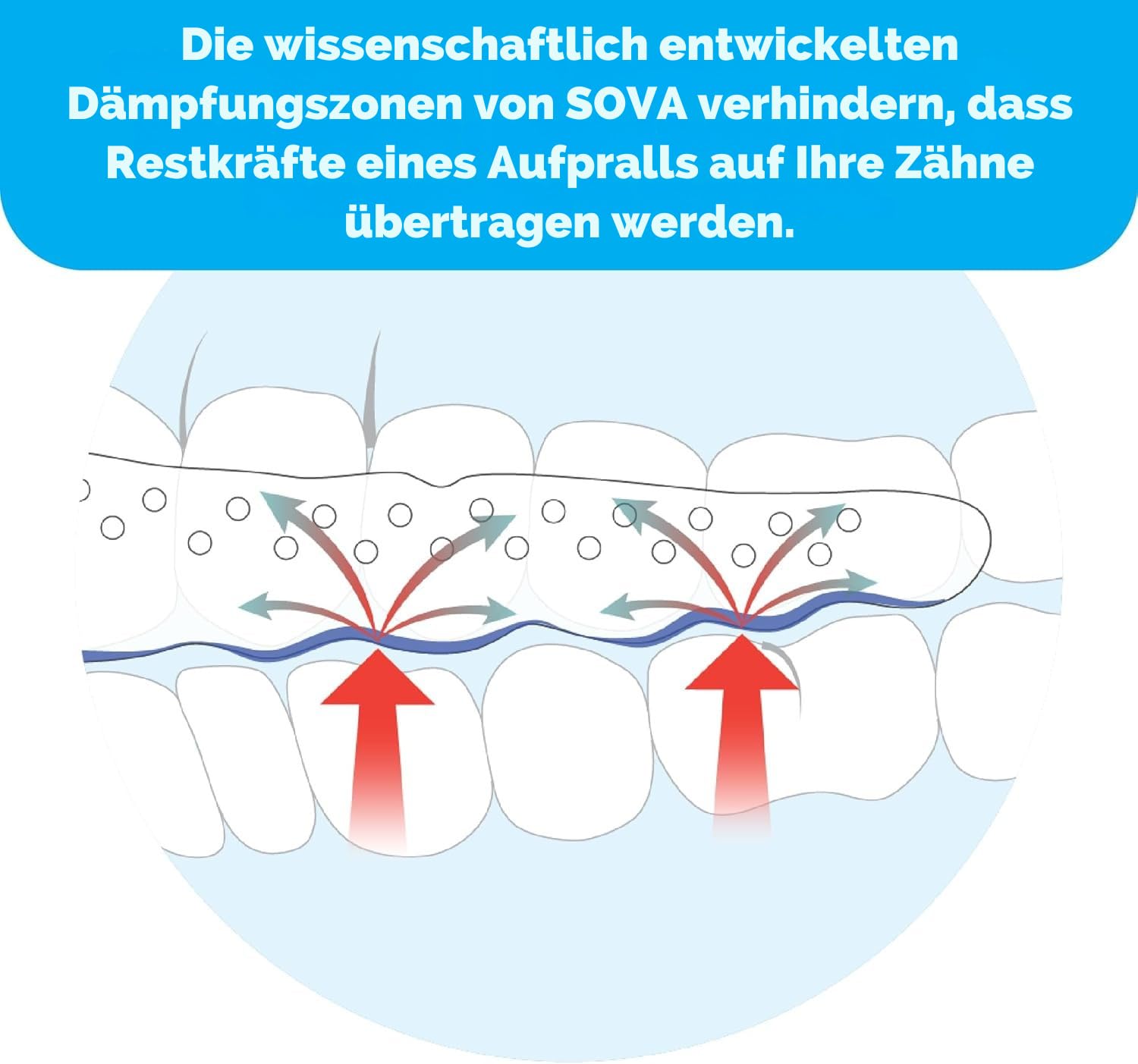 SOVA Aero Aufbissschiene – Knirschschiene gegen Bruxismus – 1,6 mm Zahnschutz – bis zu 20 Mal umformbar – für Erwachsene