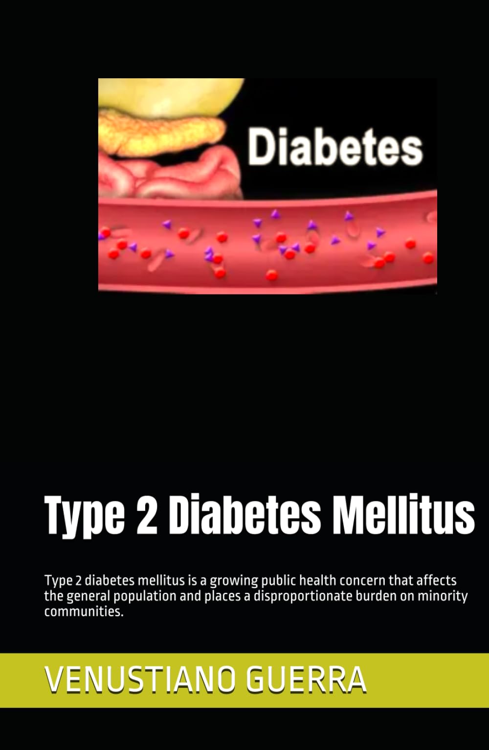 Type 2 Diabetes Mellitus: Type 2 diabetes mellitus is a growing public health concern that affects the general population and places a ... (Medical Publications for lay people)