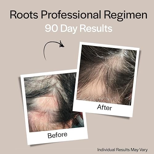 Miniatura 6 de Roots Professional Founder's Formula Scalp Topical Therapy  Tratamiento de pérdida de cabello  Estimula el crecimiento del cabello  Formulado con