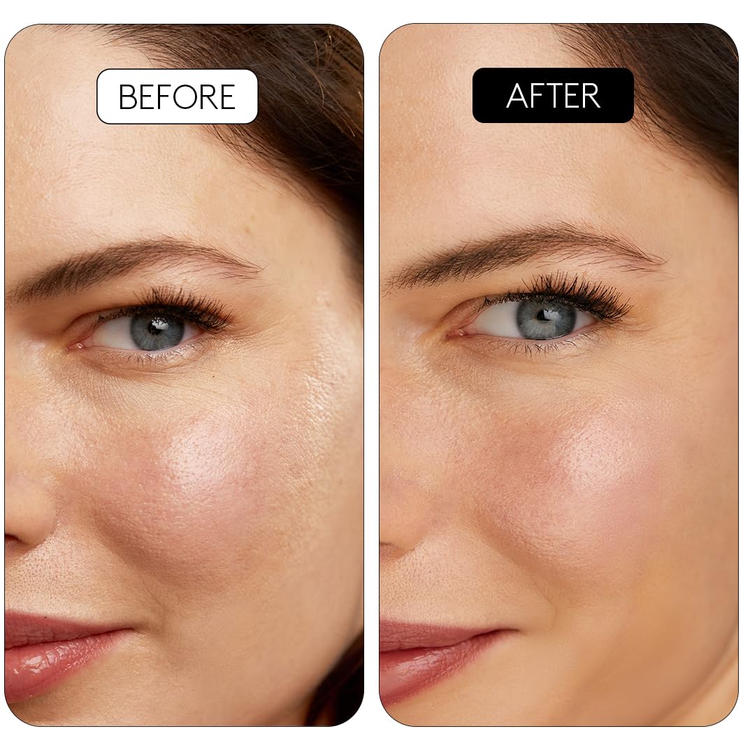 COCUNAT - CLINICAL RETINAL 0.1 - Vitamin A Retinal Serum - Reduces Wrinkles, Spots and Flaccidity - Regenerates and Rejuvenates - For All Skin Types - With Niacinamide and Hyaluronic Acid