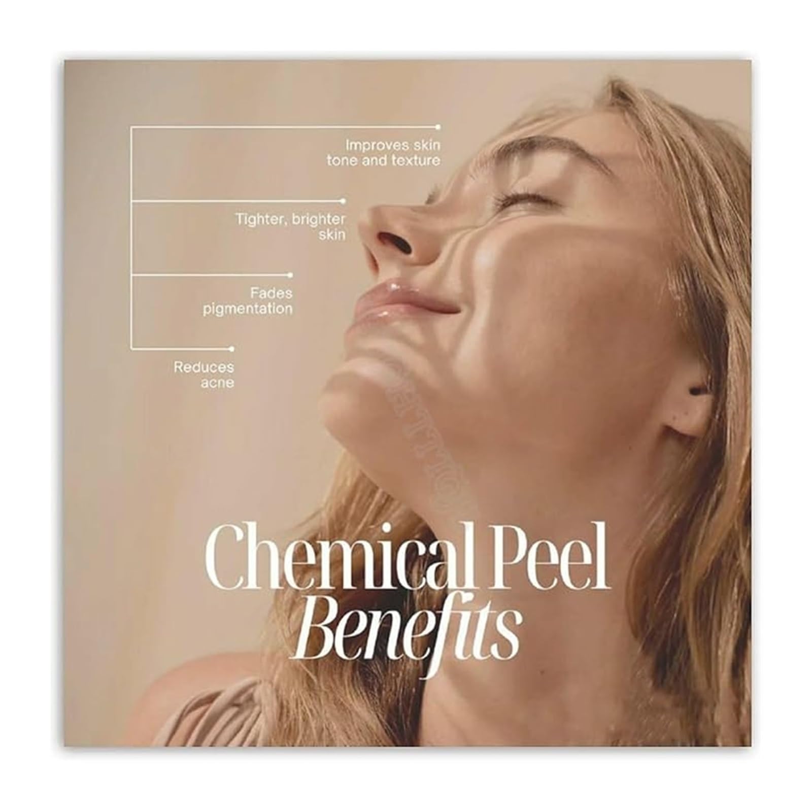 EKFBQBGW Dermatology Clinic Chemical Peel Guide Poster Benefits Chart Canvas Painting Framed,16x24inch(40x60cm)