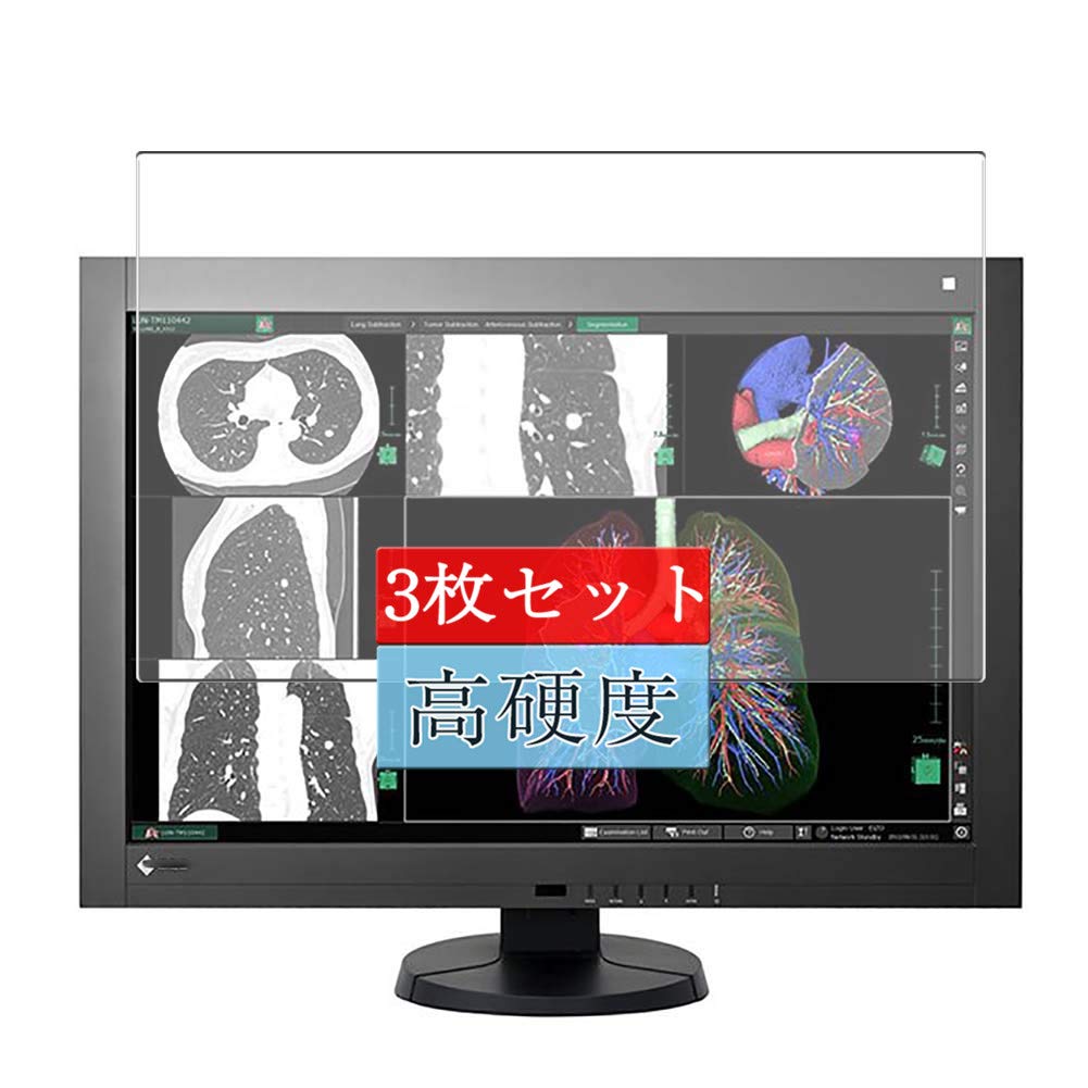 Amazon | 3枚 Sukix フィルム 、 EIZO RADIFORCE RX440 29.8