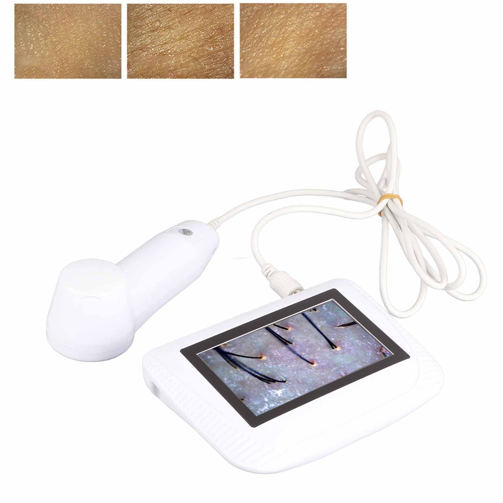 Analizzatore Diagnostico Capelli e Pelle Professionale, Tricocamera 5 Pollici con Ingrandimento 50x-200x, Rilevatore di Cuoio Capelluto, Misuratore Umidità Oleosità, Diagnosi Digitale LCD per Viso Fo