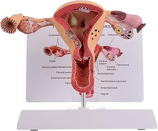 1Pc Female Reproductive Organs Anatomy Model Uterus Model, Pathological Uterus and Ovary Anatomical Model - Human Female Medical Anatomy.