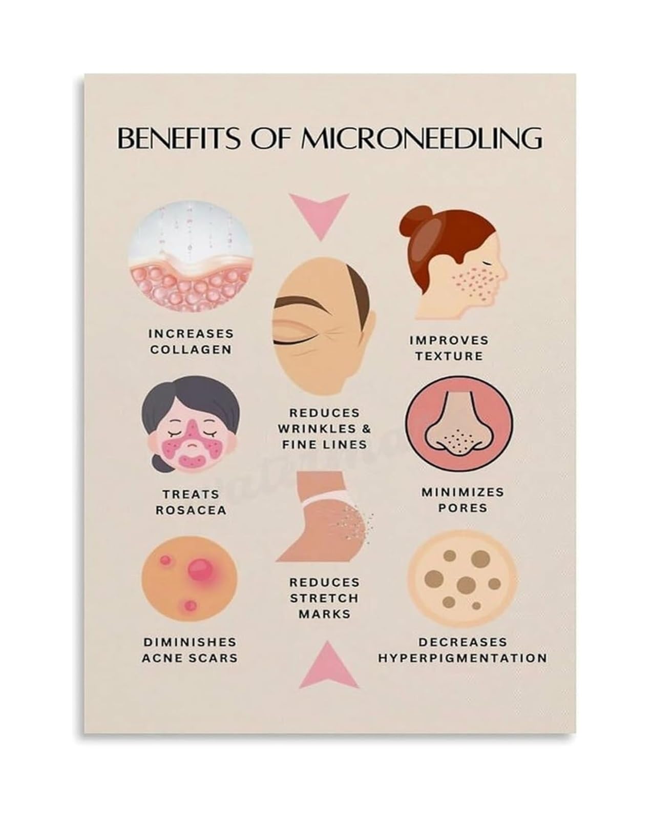 MDBJTCYZN Aesthetic Skincare Wall-Art Microneedling Benefits and Process Poster Modern Minimalist Decor for Beauty Salon Spa Clinic Waiting Room or Home Studio(Framed,08x12inch(20x30cm))