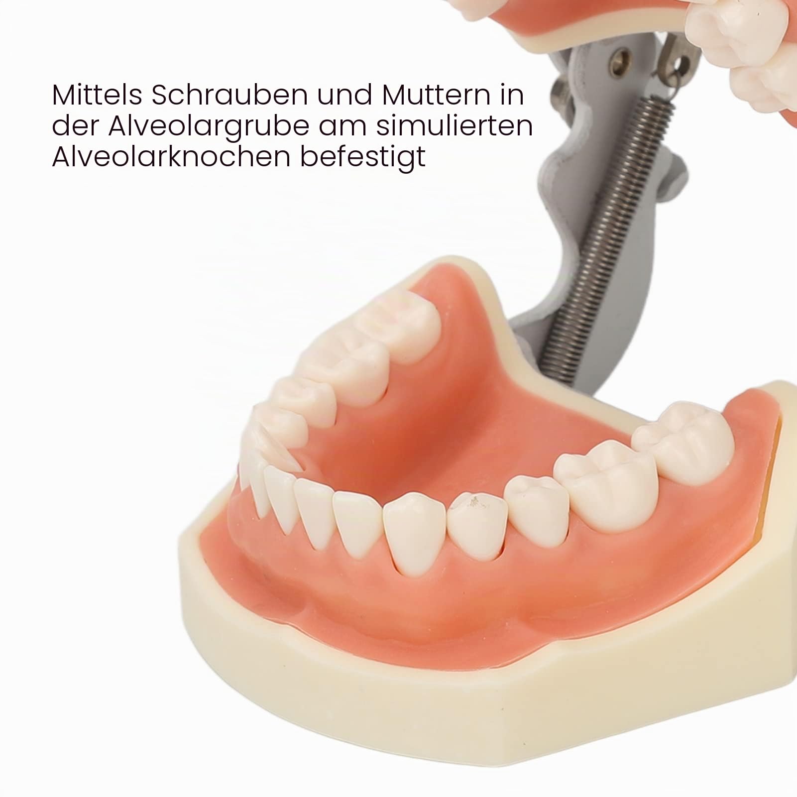 Dental Typodont Zähne Modell, Weichem Zahnfleisch Zahnmodell, Oberkieferzyste Zahnmodell 28 Zähne weiches Zahnfleisch Zystenzähne Lehrmodell zum Üben von Inzisionsabszessen