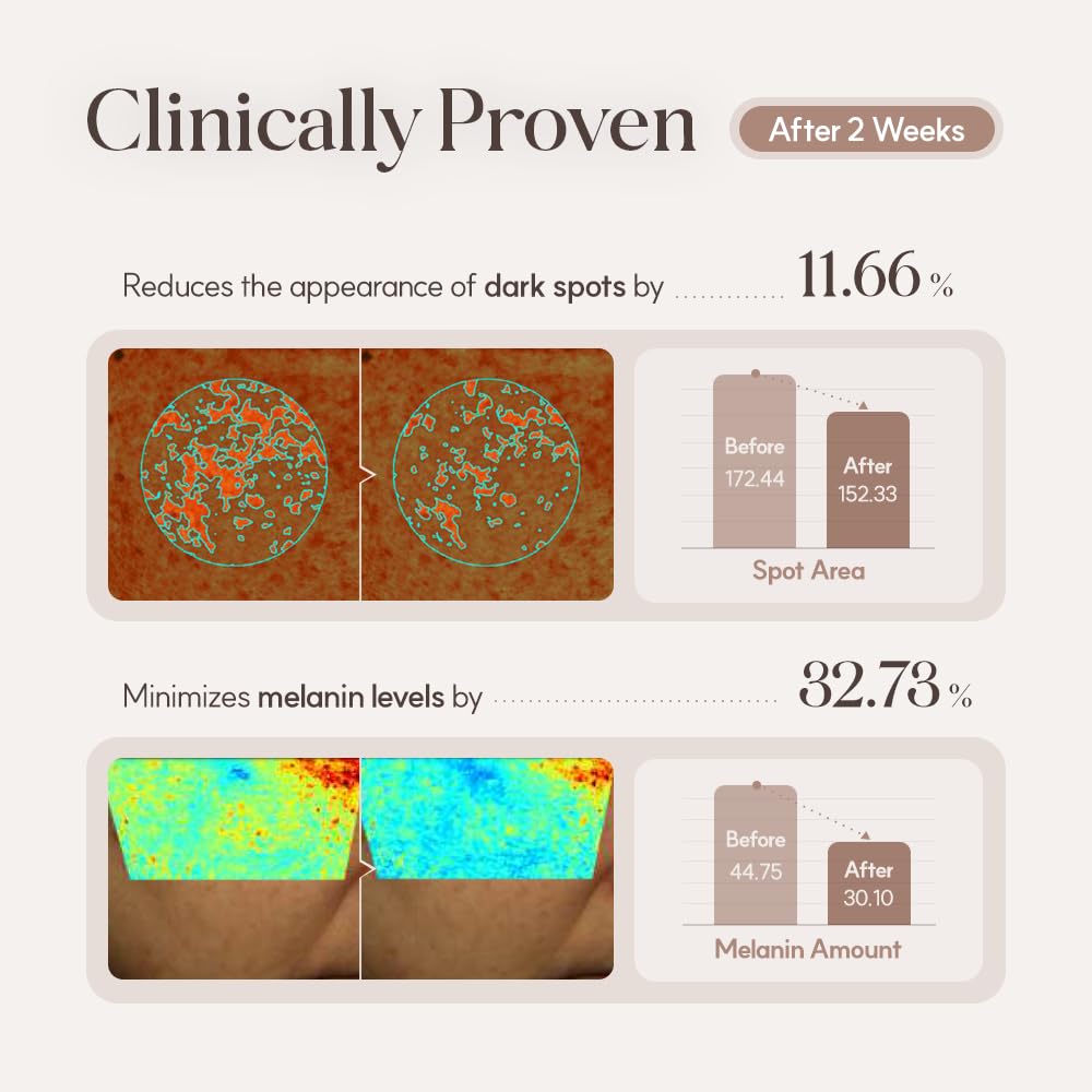 Mela Clinic Ampoule with NK Cell Technology, Skin Tone Care Serum with Tranexamic Acid, Glutathione & Bisabolol, 0.5 fl oz - Image 3