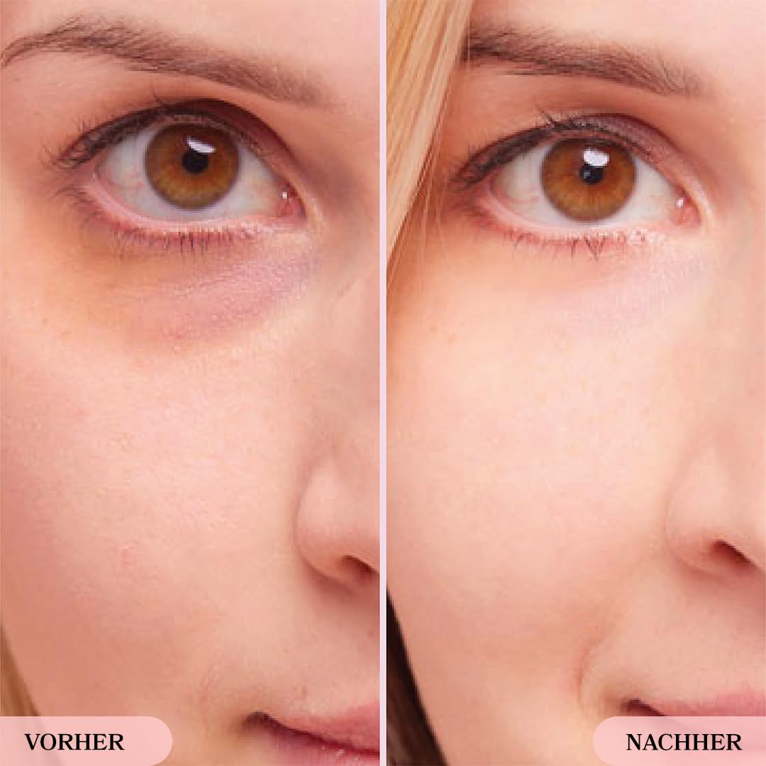 LE GUSHE - Augenpads Gegen Augenringe, Eye Pads / Augenpads Gegen Tränensäcke und Falten, Erfrischende Augenmaske, Gel Eyepatches [20 Paare, Gold]