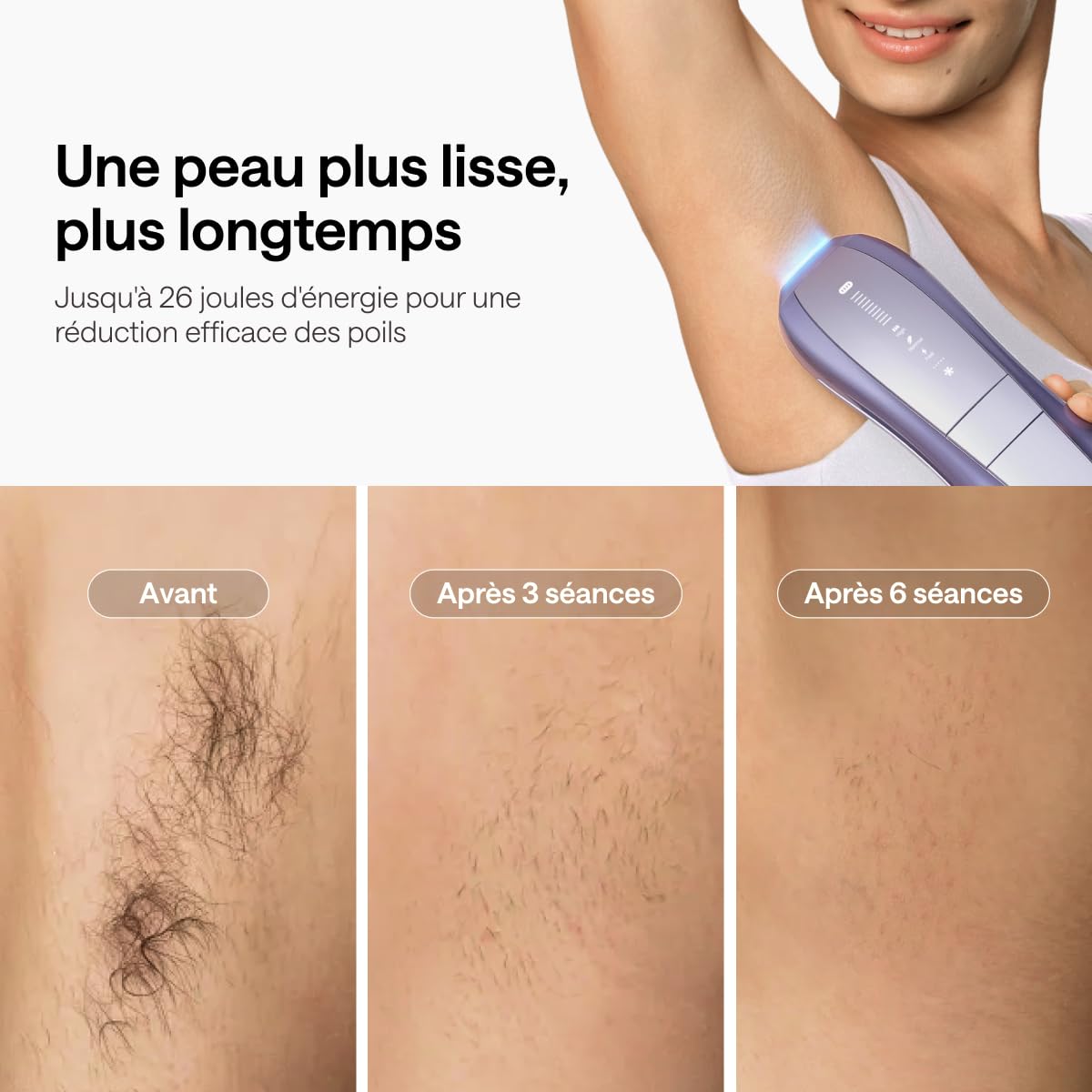 Ulike Air 10 Pro Épilateur Lumière Pulsée IPL Femme Homme – Épilateur Électrique Visage & Corps, Double Lampe, Mode SHR, Sapphire Ice Cooling Indolore, SkinSensor – Résultats Visibles en 2 Semaines