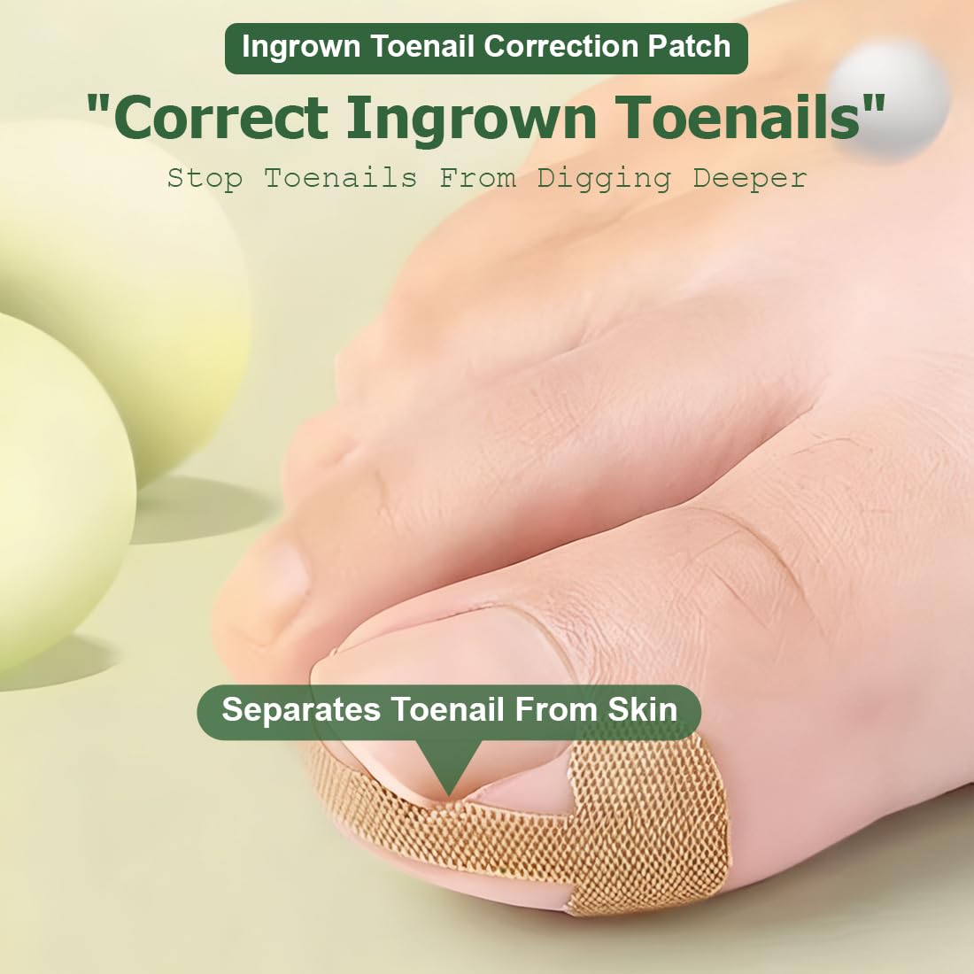 80 Piezas Korrección de Uñas Encarnadas, Parche Corrector de Uñas de los Pies,Parche de Corrección de Uña Encarnada Elástico, Pegatinas de Uñas Encarnadas, para Mujeres y Hombres