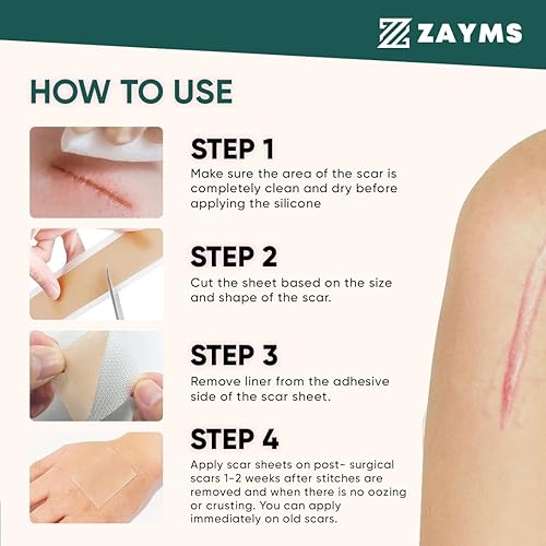 Miniatura 4 de Cinta de silicona para cicatrices (rollo de 1.6 x 120 pulgadas, rollo de 9.8 ft), láminas de silicona para cicatrices para eliminación de