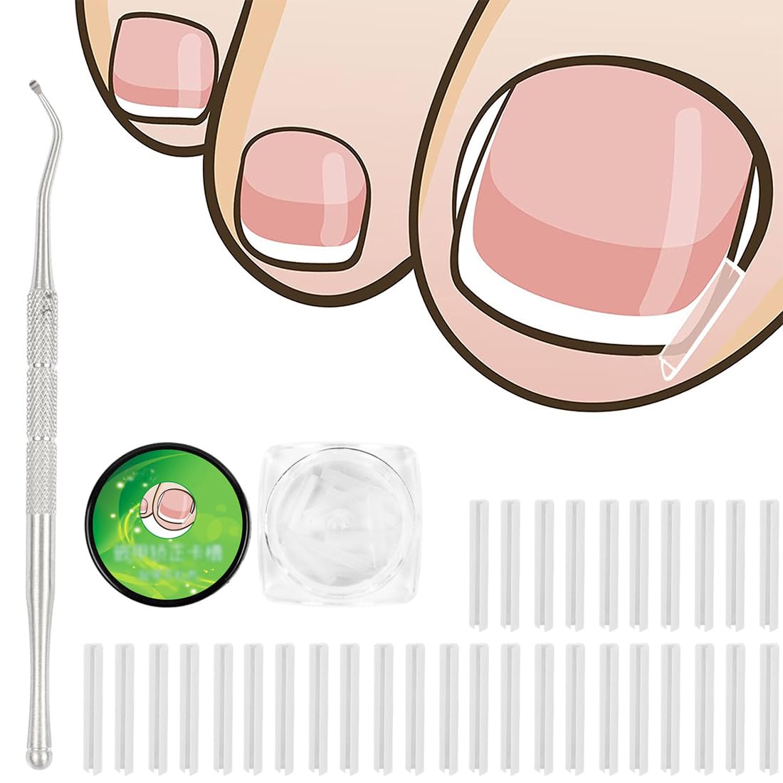 50 pezzi Set correttore per unghie incarnite, Strisce raddrizzanti per unghie incarnite senza dolore con sollevatore per unghie, Kit di strumenti per unghie incarnite facili da usare