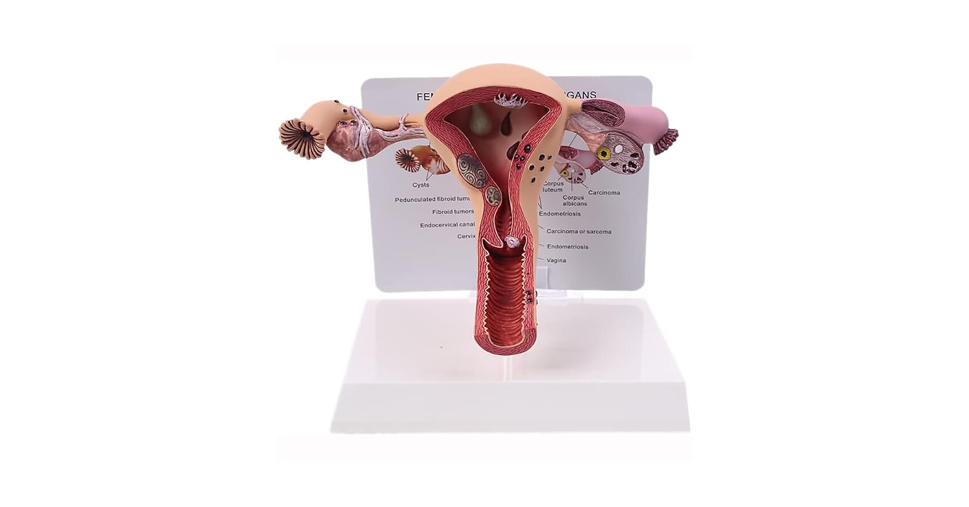 61AqirWL0yL.jpg_BO30,255,255,