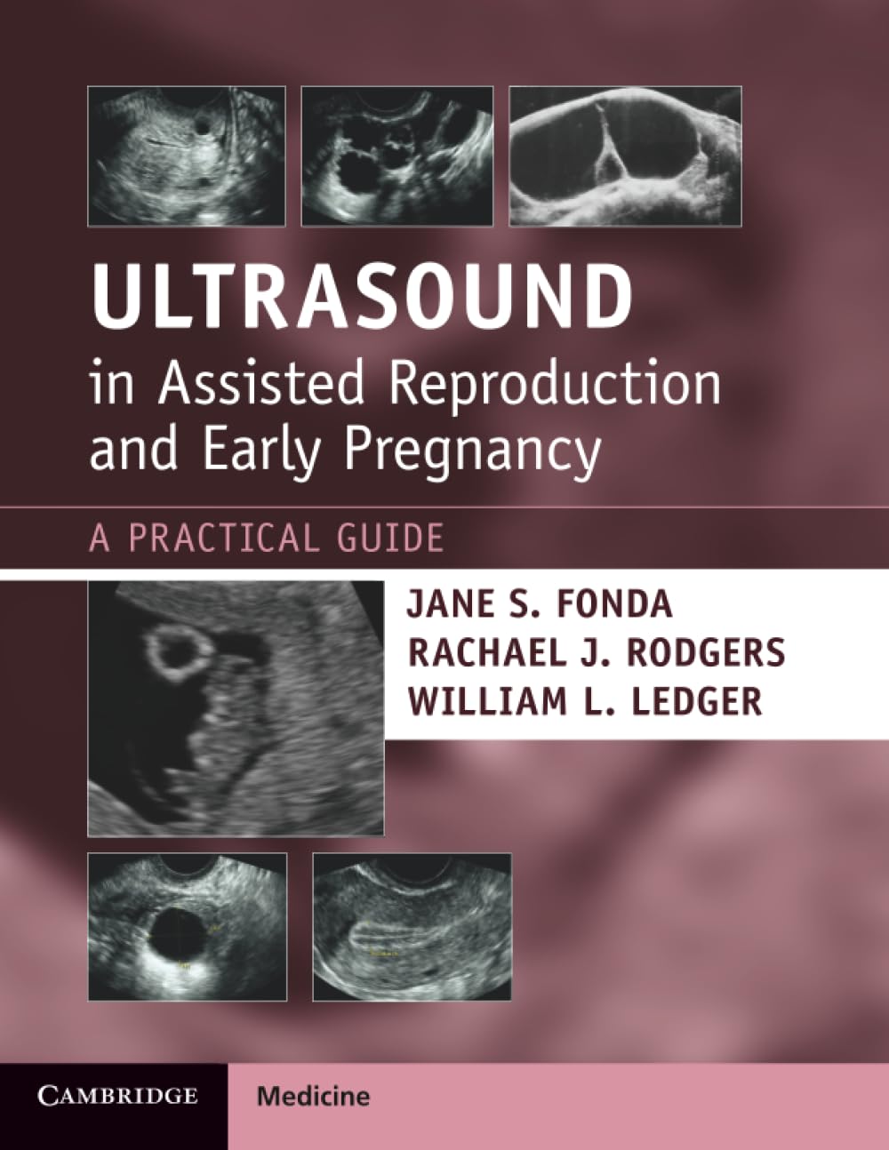 Ultrasound in Assisted Reproduction and Early Pregnancy: A (New)