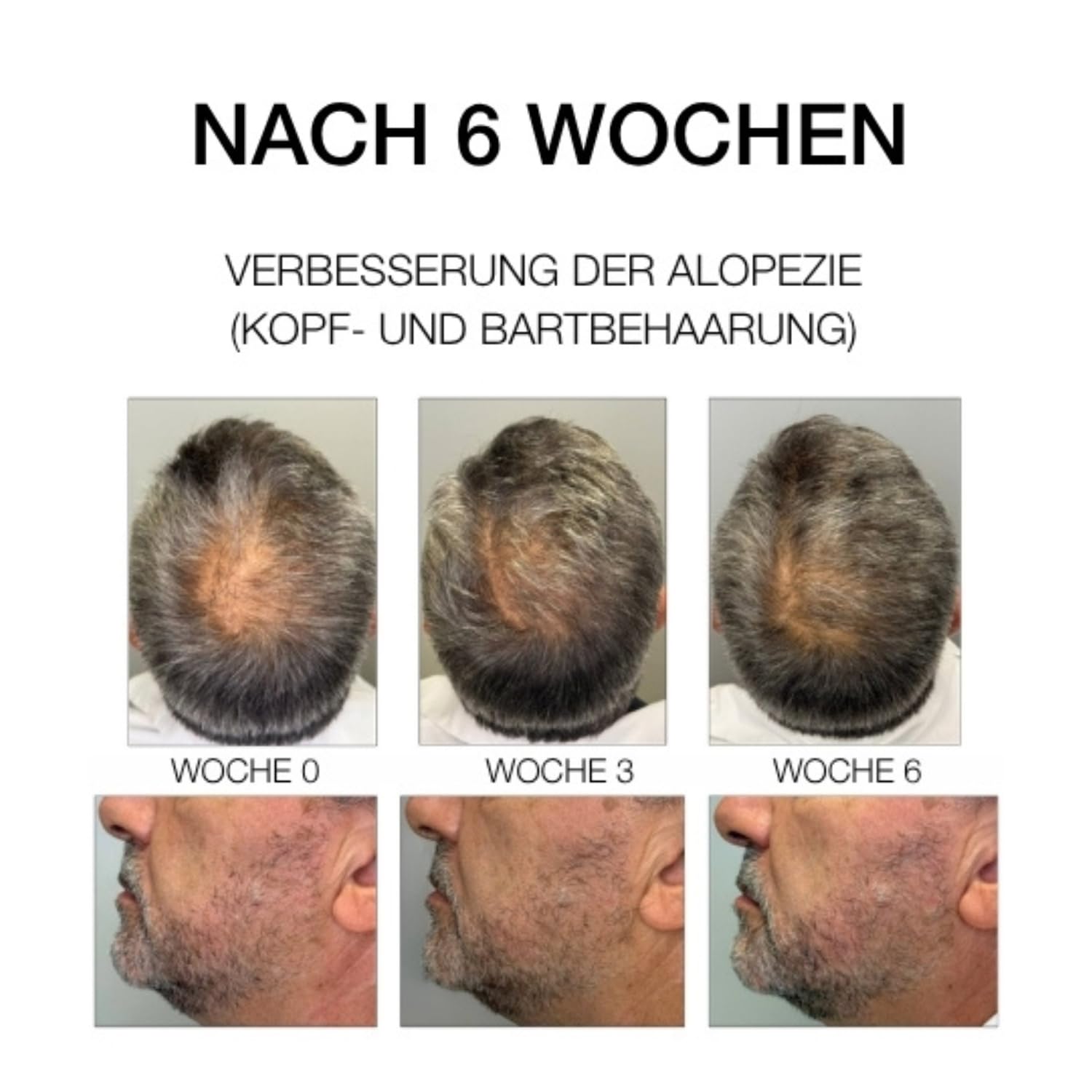 DIEGO DALLA PALMA MILANO - ESTREMIRIMEDI Serum 6 Kräftigende Pflege für Kopfhaut und Haar. Stimuliert die Mikrozirkulation. Stärkt die Haarfaser. 50ml