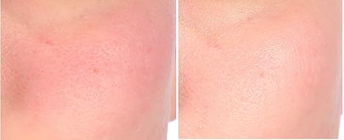 Miniatura 5 de Nakery Tratamiento de reparación intensiva para aliviar el eccema crema calmante para rostro y cuerpo  2% de avena coloidal  Alivio inmediato