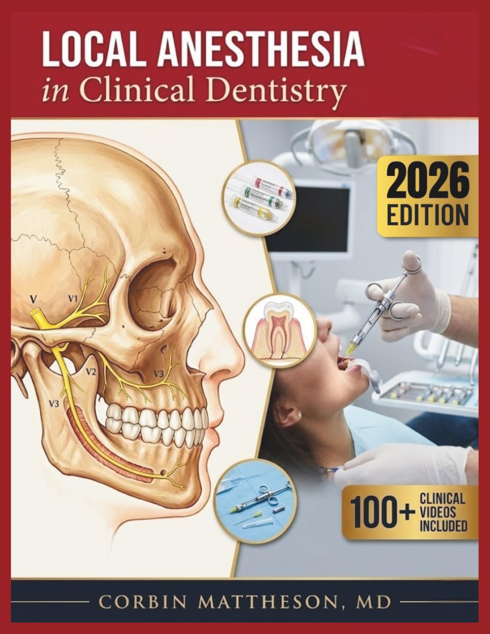 LOCAL ANESTHESIA IN CLINICAL DENTISTRY: Principles, Techniques, and Pain Management for the Dental Professional