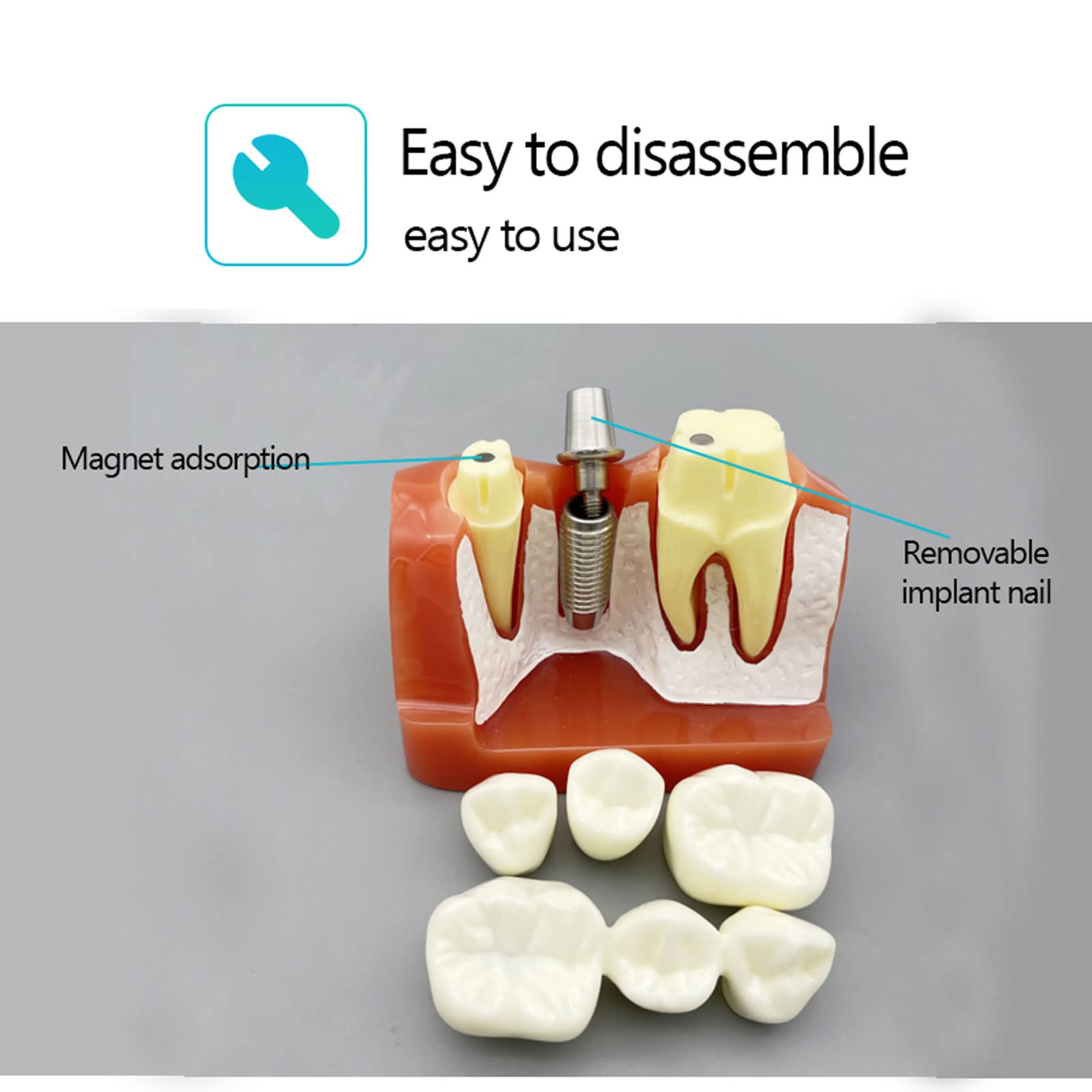 Modello di Denti Analisi, Modello Dentale per Dimostrazione dello Strumento di Insegnamento Dentale in Studio,Denti Analisi Impianto per L'insegnamento e Ricerca Odontoiatrica