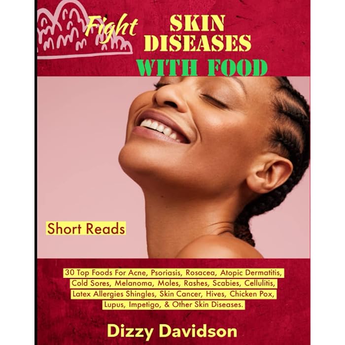 Buy Fight Skin Diseases With Food 30 Top Foods For Acne, Psoriasis