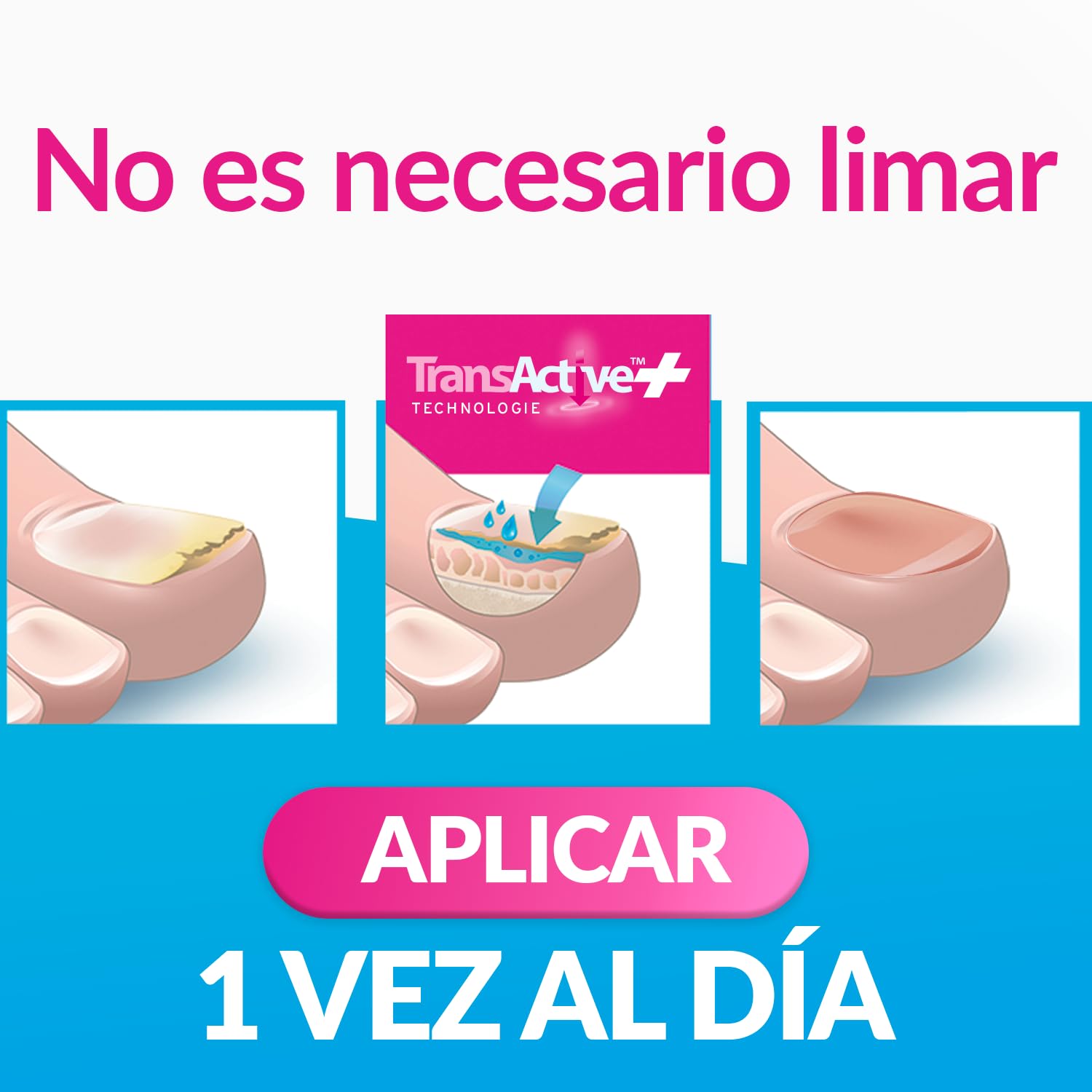 EXCILOR - Tratamiento De La Micosis De Las Uñas - Forte Color Nude - Fórmula Extra Fuerte - Tratamiento y Cobertura - Tratamiento para uñas 30 ml + Esmalte 8 ml - Clínicamente probado