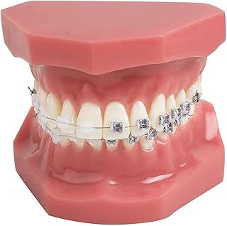 歯科モデル、矯正モデル、金属口腔デモスタンド付き矯正歯科モデルは、歯科医師が患者とコミュニケーションできるようにする