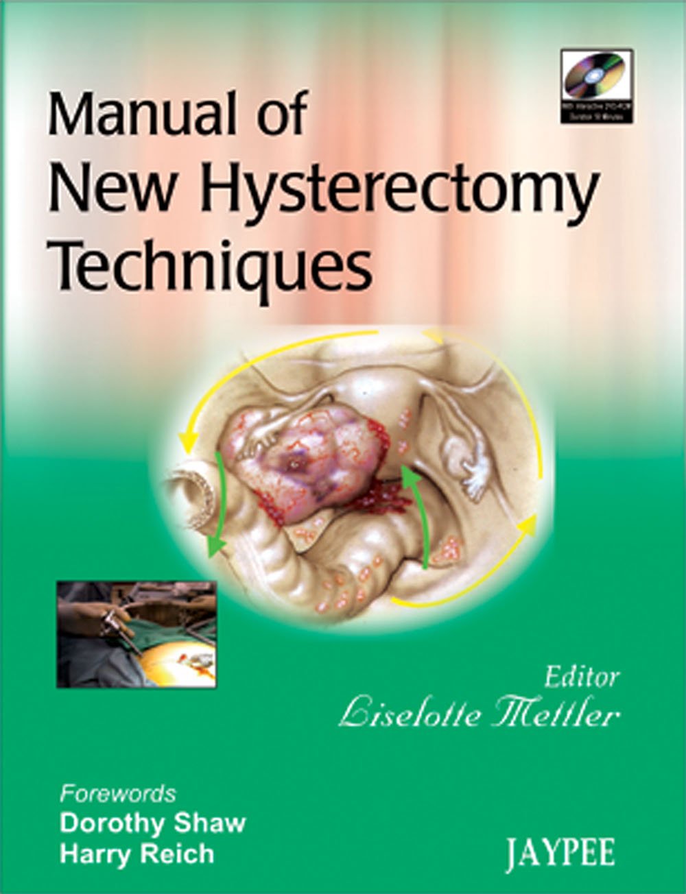 MANUAL OF NEW HYSTERECTOMY TECHNIQUES WITH INCT.DVD-ROM