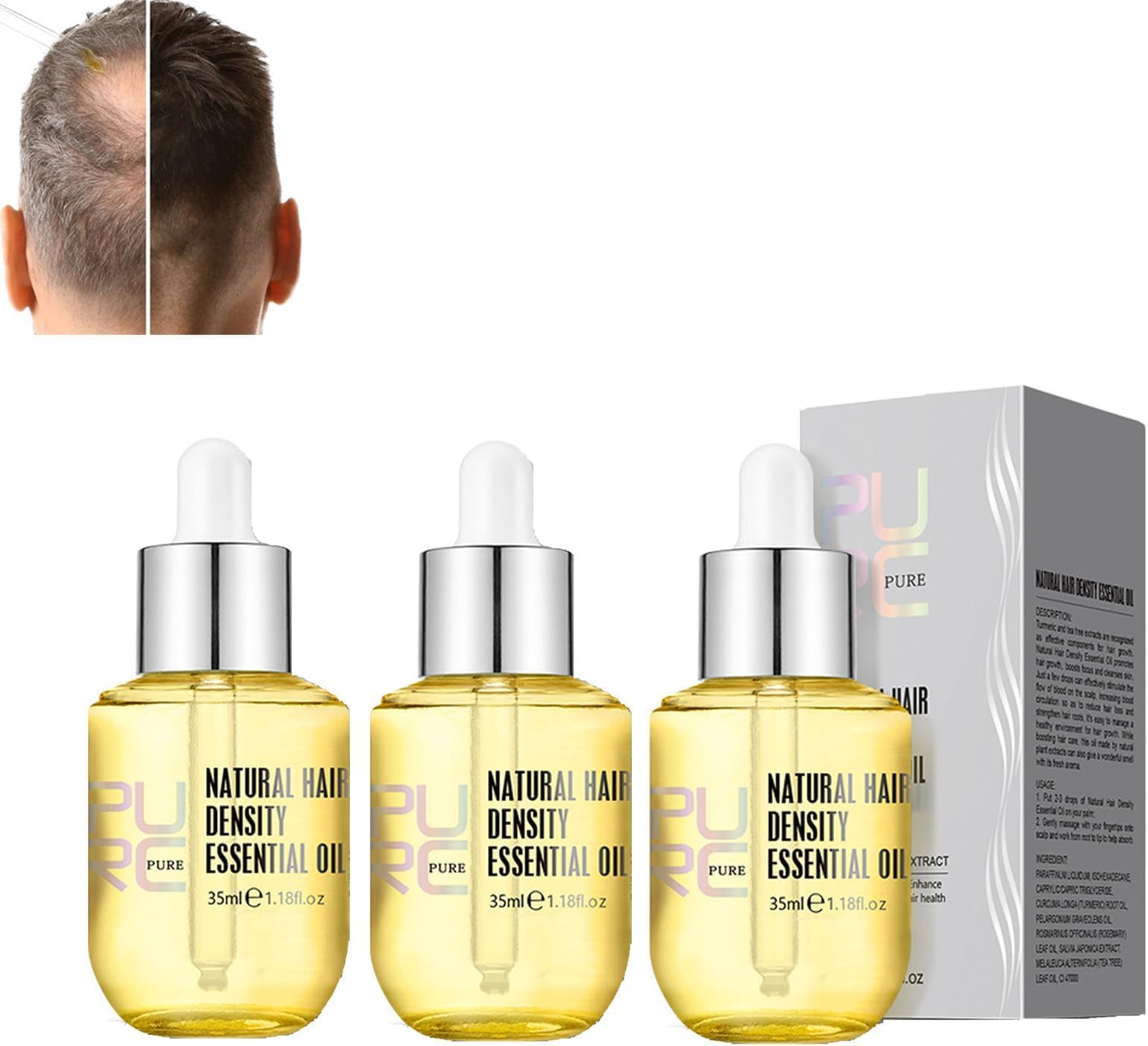 Hair Growth Essential Oil, Natural Hair Essential Oil, Hair Growth Serum for Hair Strengthen, Botanical Hair Regrowth Essence, Fast Grow Treatments for Vertex Hair Loss and Thinning Hair (3 Pieces)