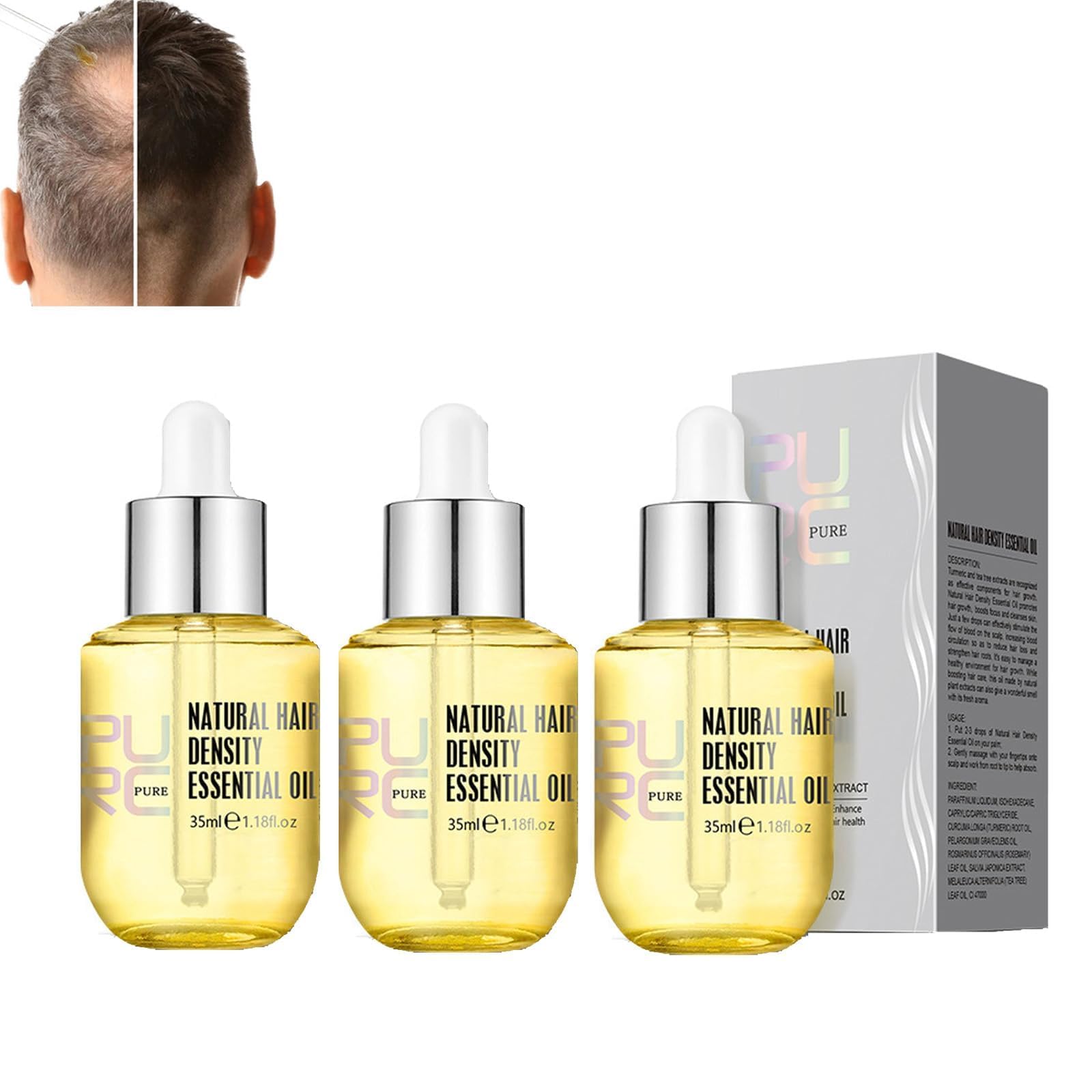 Hair Growth Essential Oil, Natural Hair Essential Oil, Hair Growth Serum for Hair Strengthen, Botanical Hair Regrowth Essence, Fast Grow Treatments for Vertex Hair Loss and Thinning Hair (3 Pieces)