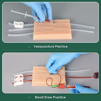 Ultrassist IV Injection Practice Kit, Venipuncture & IV Insertion Training Set, Phlebotomy Practice Simulator for Nursing Students Educational Use Only