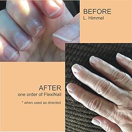 FlexiNail Penetrating Fingernail Conditioner and Strengthener to repair and then maintain weak and peeling or brittle and splitting nails