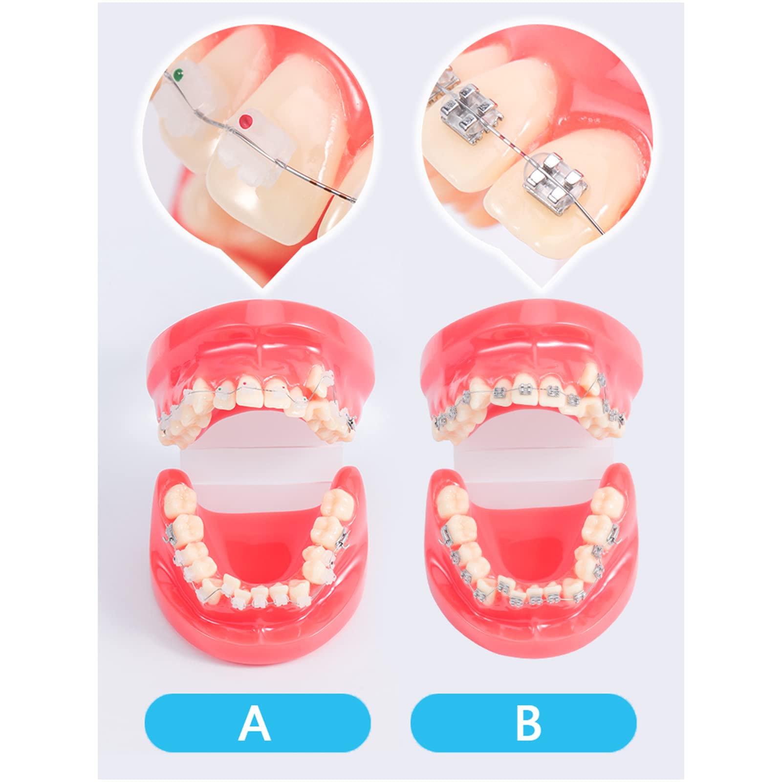 Model zębów dentystycznych-model demonstracyjny ortodoncji-dentystyczny z metalowymi wspornikami model zębów ortodontycznych do celów edukacyjnych nauka narzędzie dydaktyczne(A) (A)