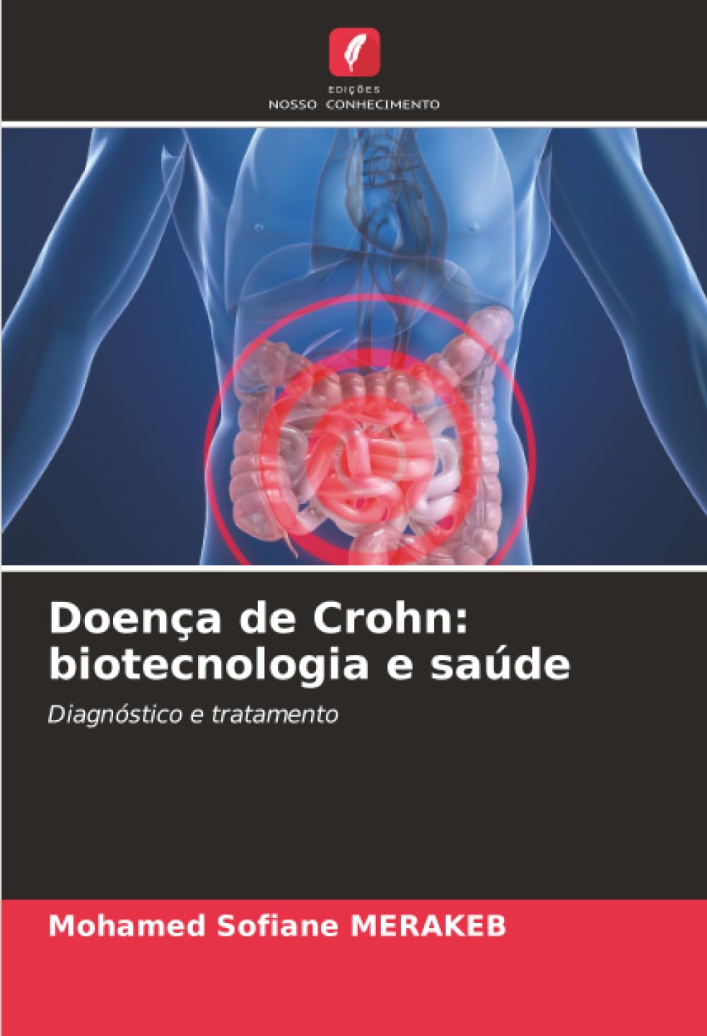 Doença de Crohn: biotecnologia e saúde: Diagnóstico e tratamento