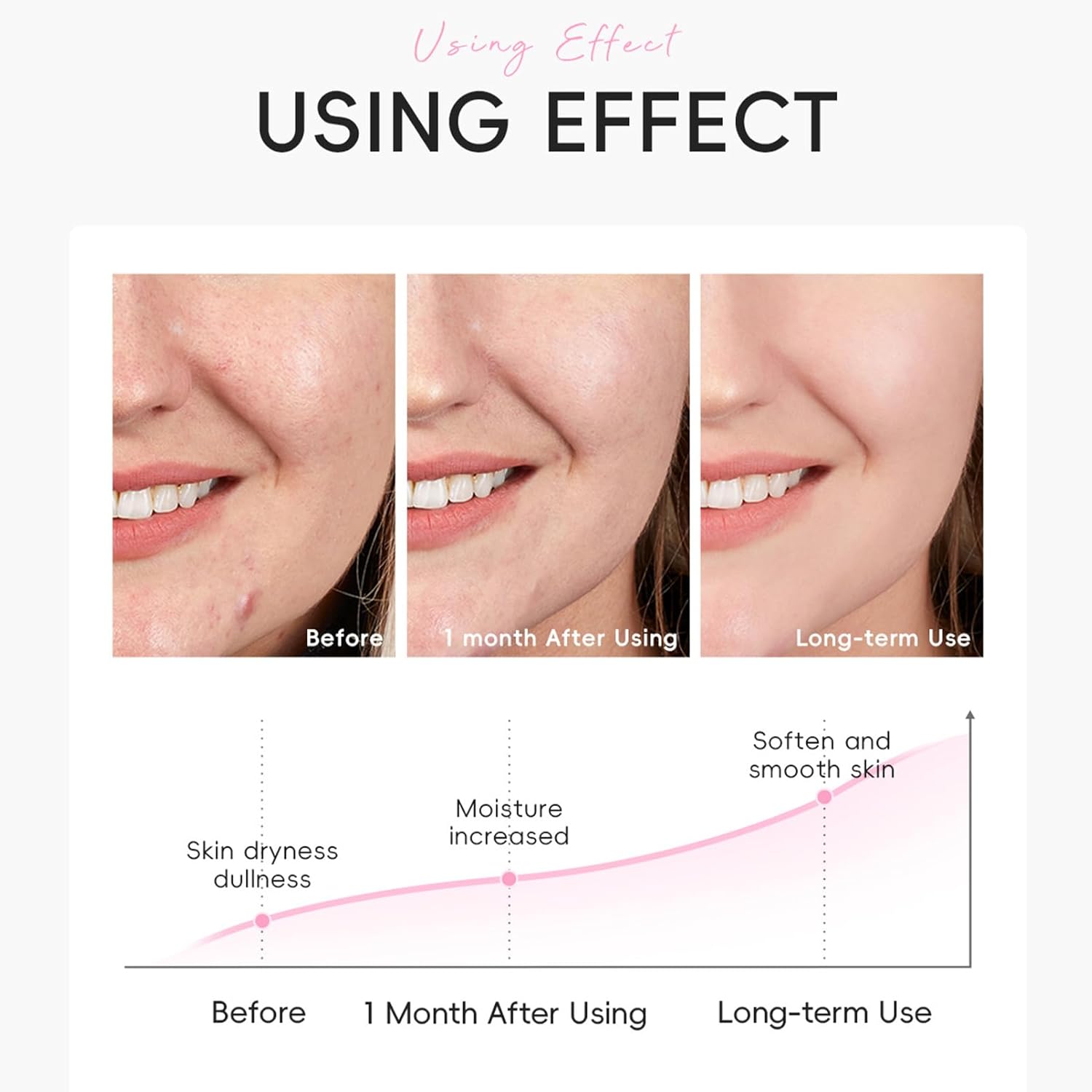 Milk Skincare for Kids, 10 PCS Teen Skin Care Kit with Cleanser, Serum, Cream, Masks, Skin Care for Teens 10-12, Hydrating Travel Skincare Sets, Christmas Gifts for Teenage Girls & Tweens (Milk) - Image 7