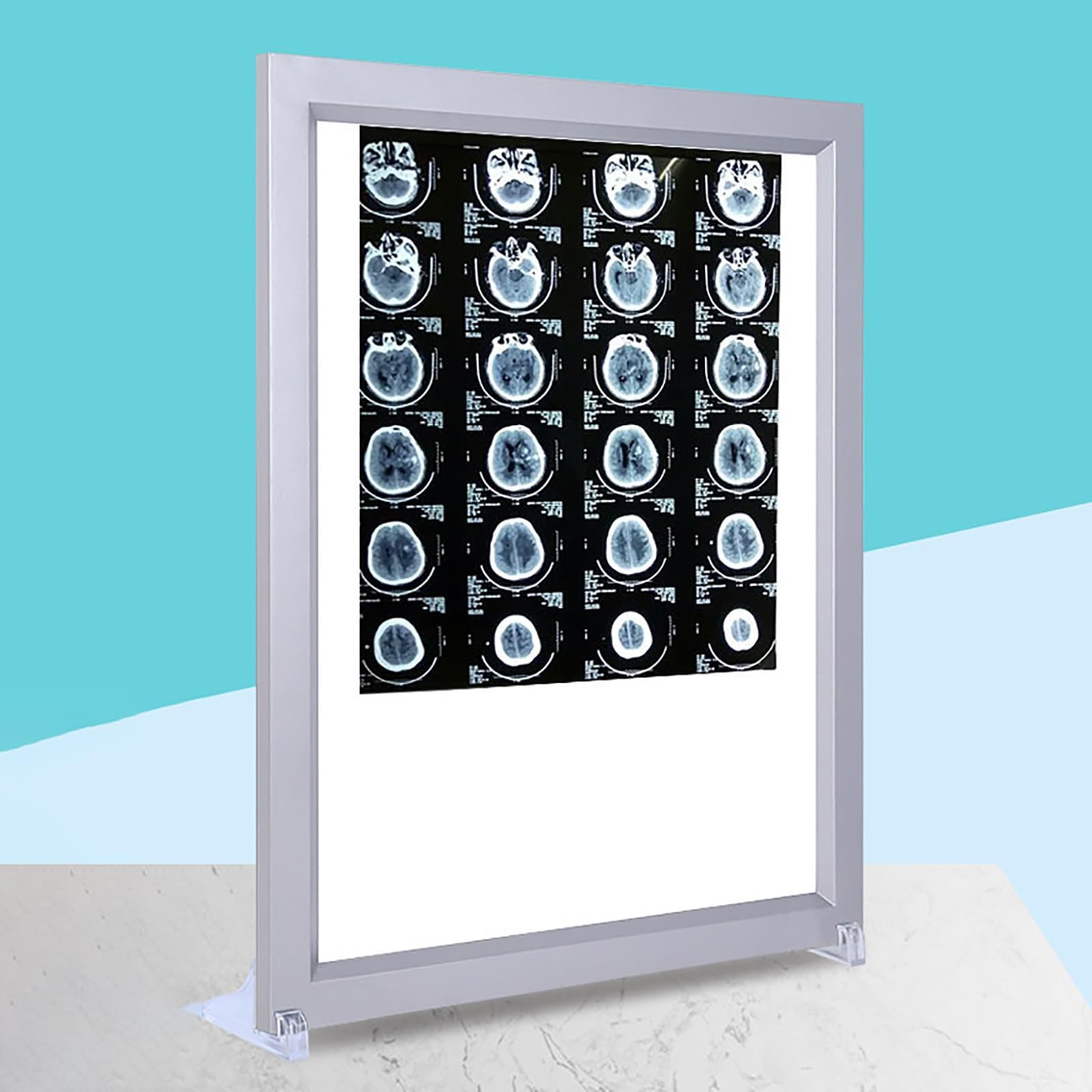 X-Ray LED View Box, Adjustable Brightness Light Screen Viewer with Flicker-Free Display for X-Ray CT MRI Film Viewing