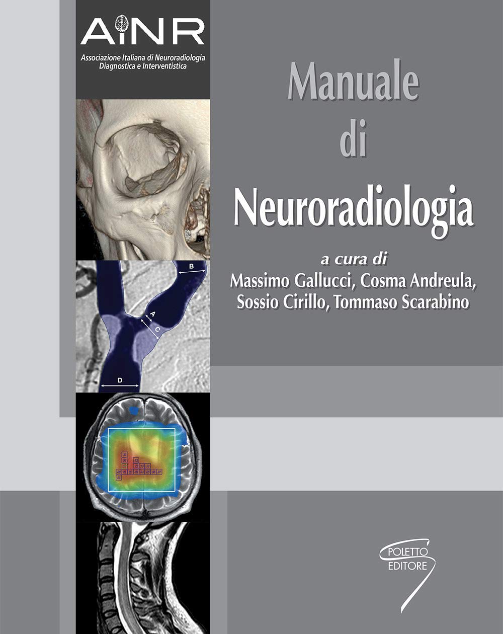 Manuale Di Neuroradiologia - 4