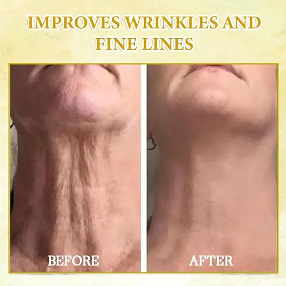 Skin Firming Rejuvenating Oil,Natural Anti-Aging Facial Serum,Day & Night Anti-Wrinkle Serum for All Skin Types-Firming, Hydrating for Men&Women Face Moisturizer,After Shower & Bath Oil (1)