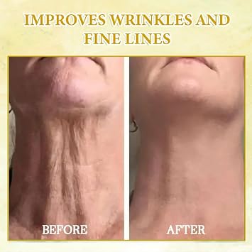 Skin Firming Rejuvenating Oil,Natural Anti-Aging Facial Serum,Day & Night Anti-Wrinkle Serum for All Skin Types-Firming, Hydrating for Men&Women Face Moisturizer,After Shower & Bath Oil (1)