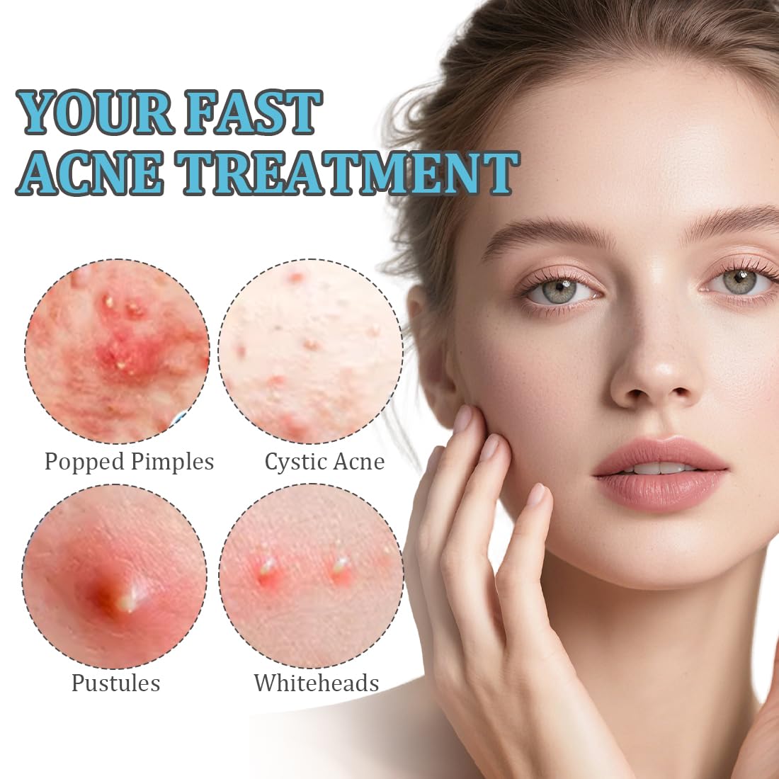 Strisce per punti neri e impurità,720 cerotti per l'acne, adesivi per il trattamento dell'acne per feste di trucco