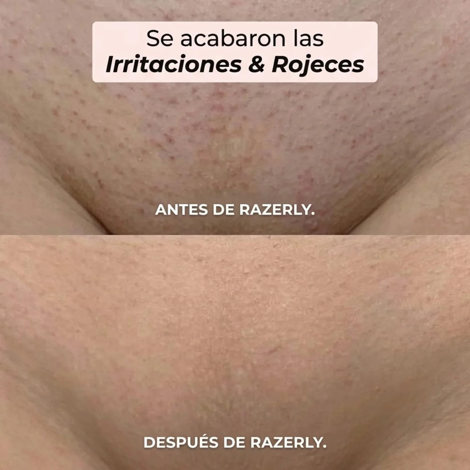 Razerly Maquinilla Mujer, Maquinilla 2 En 1para Bikini Ycuerpo Razerly, Razerly Depiladora, Maquinilla Electrica Femenina Para Zona Intima Axilas Piernas Y Piel Sensible (Rosa)