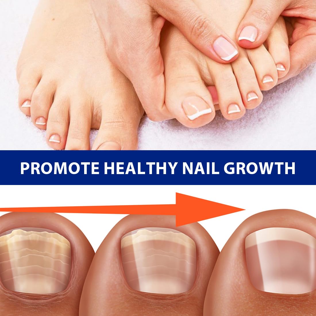 GXGM 42 Pezzi Fungal Nail Patches, Toppe Fungine per Unghie, Toppe per Unghie Fungo, Cerotti Multiuso per la Riparazione Delle Unghie dei Piedi Danneggiate Delle Unghie Scolorite
